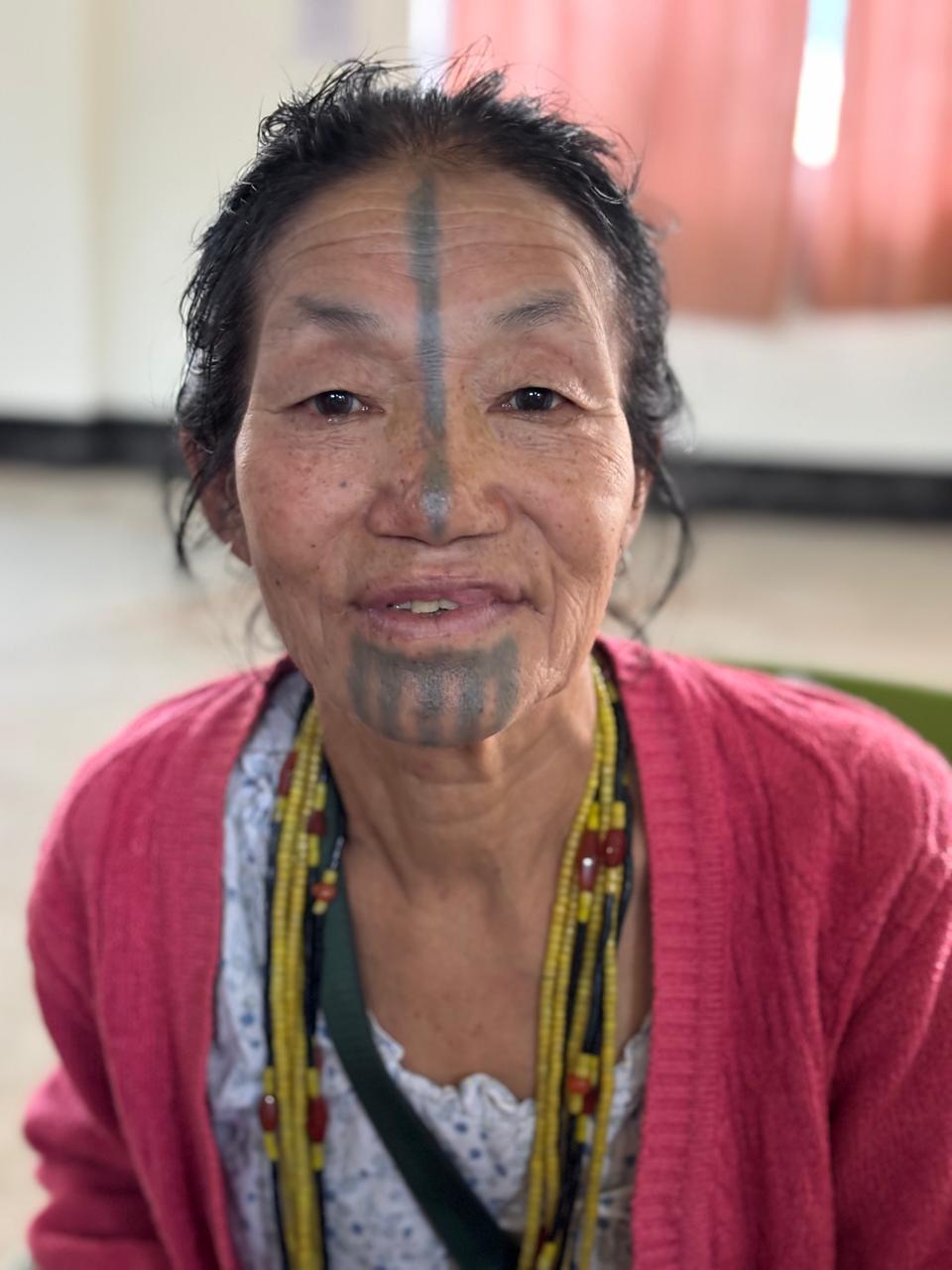Free Eye Camps Setup